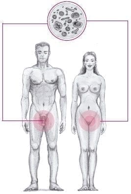 Ampollas genitales