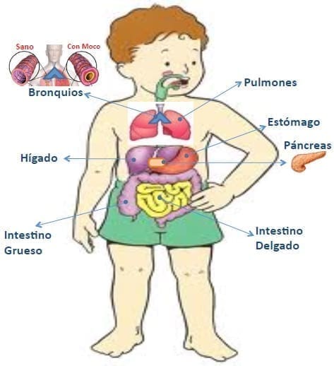 Fibrosis Quistica, Glosario Visual