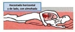 Drenaje postural