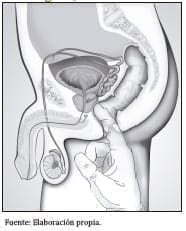 Tacto rectal