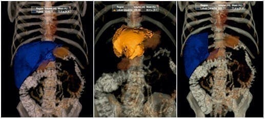 Exámenes diagnósticos en la Valoración Preoperatoria del Paciente con Enfermedad Hepática