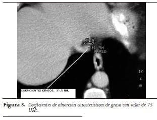 Coeficientes de absorción característicos de grasa Coeficientes de absorción característicos de grasa