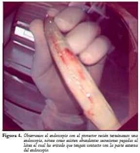Endoscopio con el protector