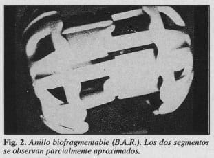 Anillo biofragmentable (BAR) Anillo biofragmentable (BAR)