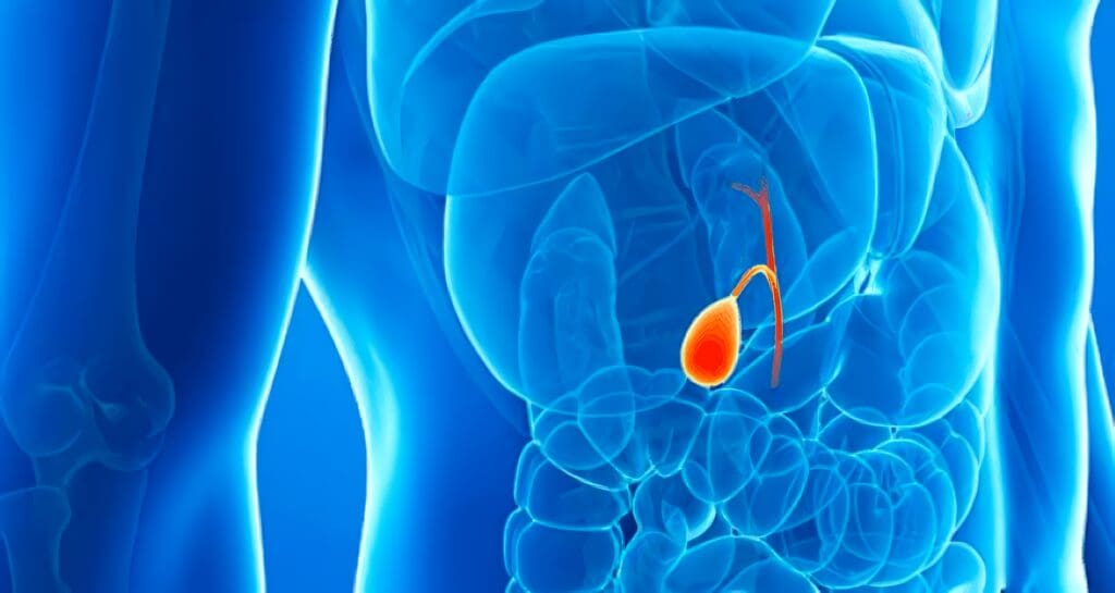 Carcinoma de Vesícula Biliar: Material y Método