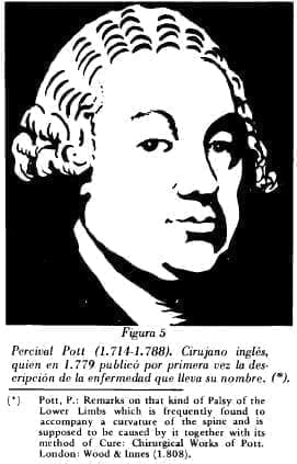 Percival Pott (1.714-1.788)