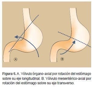 Vólvulo Mesentérico-Axial