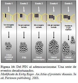 PIN al Adenocarcinoma