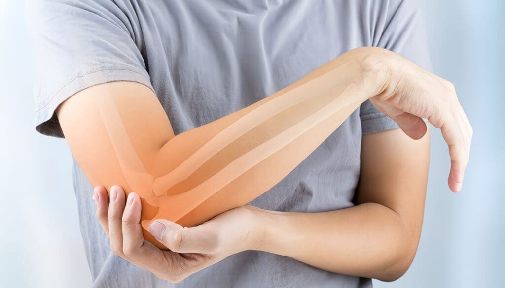 Cáncer de Huesos, Guía de Salud