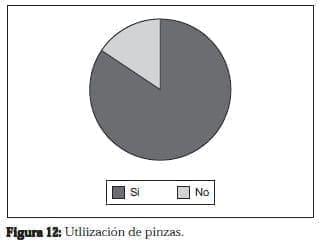 Ureterolitotomía Endoscopica, Utliización de pinzas