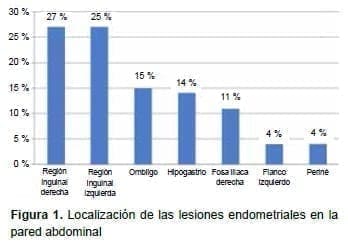 Lesiones endometriales en la pared abdominal