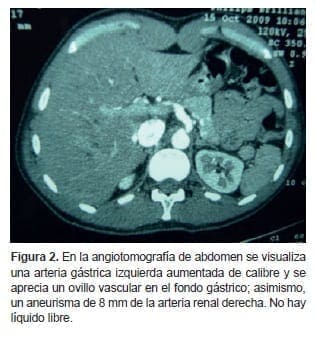 Angiotomografía de Abdomen Angiotomografía de Abdomen