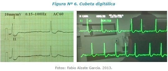 Cubeta digitálica
