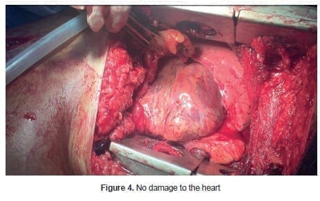 No damage to the heart