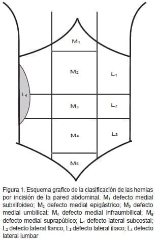 Clasificación de las hernias por incisión de la pared abdominal