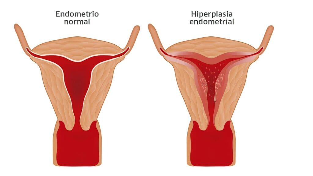 Menopausia SGM y Disminución de la Libido