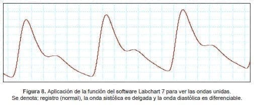 Aplicación de la función del software Labchart 7 para ver las ondas unidas