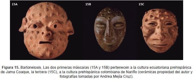 Bartonelosis. Las dos primeras máscaras