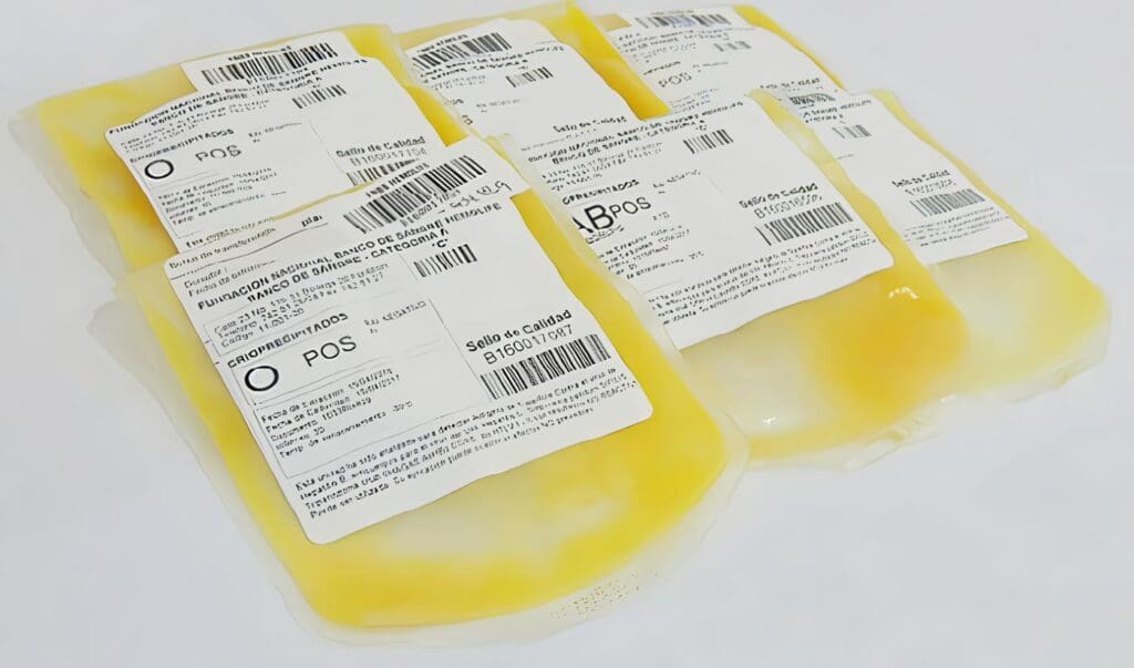 Plasma fresco congelado y crioprecipitado