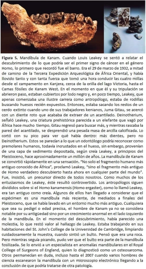 Mandíbula de Kanam Mandíbula de Kanam