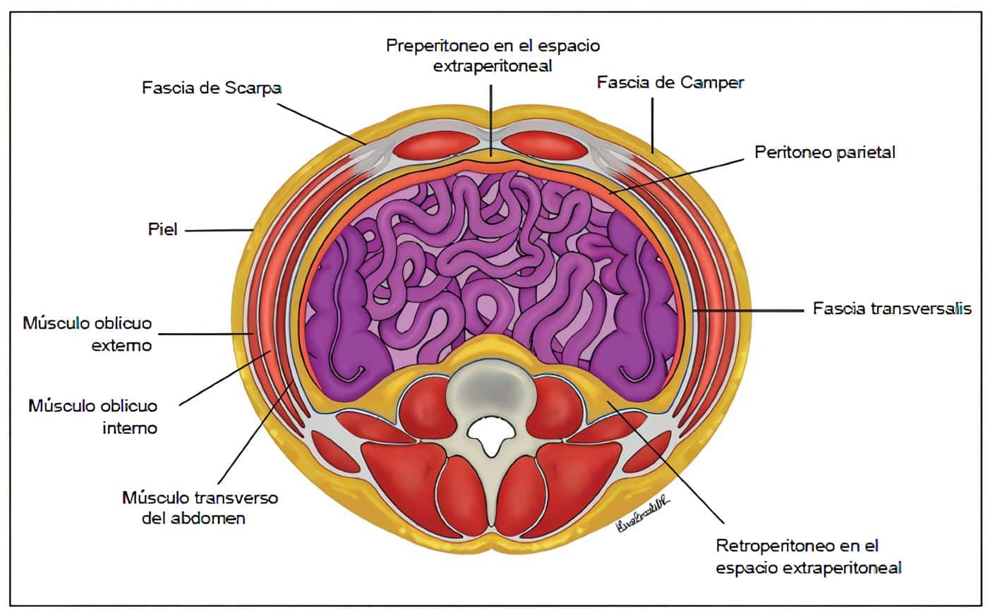 Representación gráfica del espacio extraperitoneal Representación gráfica del espacio extraperitoneal