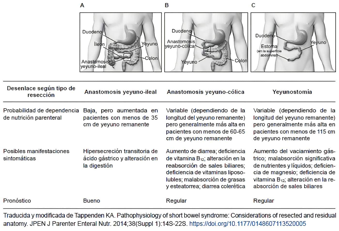 Tipos de resección intestinal y resultados asociados.