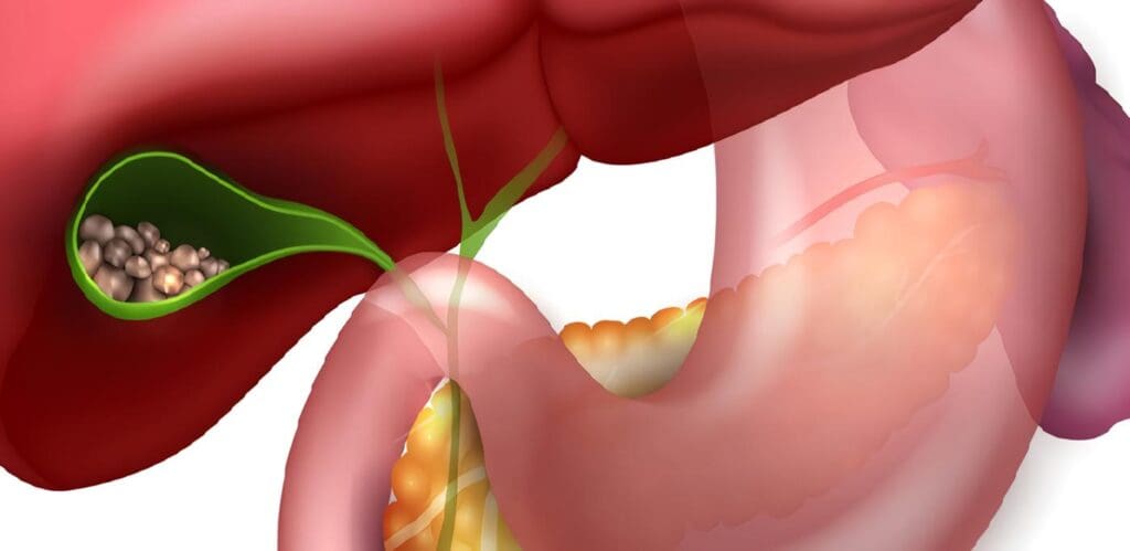 EUS en Patología Pancreática