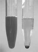 Hematuria Loin Pain