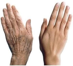 Rejuvenecer manos