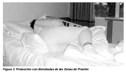 Protección con Almohadas de las Zonas de Presión - Cuidado de Enfermería en Lesiones de Piel