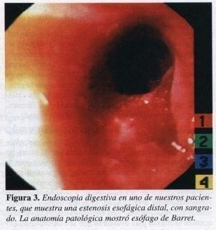 Monitorización de los Pacientes Durante la Endoscopia Gastrointestinal