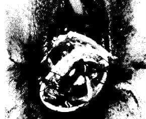 Vaginoplastia